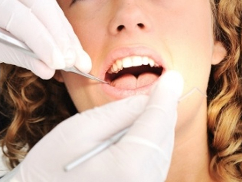 dental insurance